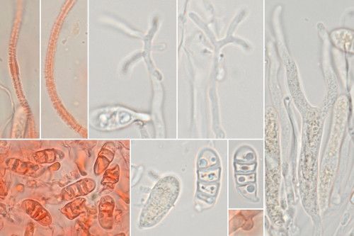 het_Dendrodacrys paraphysatum1.jpg