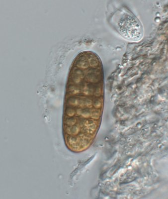 Aufnahme-1705_comp.jpg (75.5 KiB) 58964 mal betrachtet Hysterographium fraxini