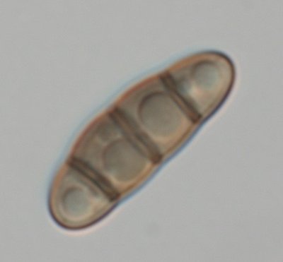 Aufnahme-1319comp.jpg (20.31 KiB) 58955 mal betrachtet Hysterium angustatum auf Betula