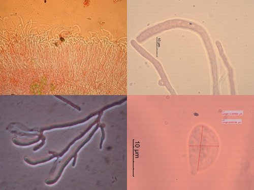 tremella-pyrenophila2.jpg