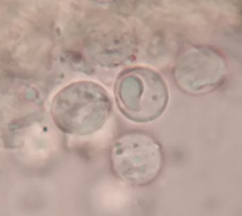 Radulomyces_rickii_Sporen01.jpg