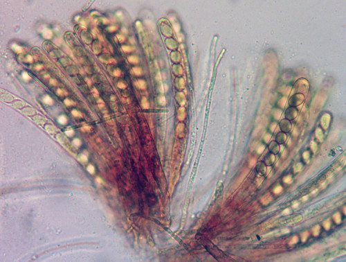 Pyronema omphalodes;Asci u. Parph.jpg