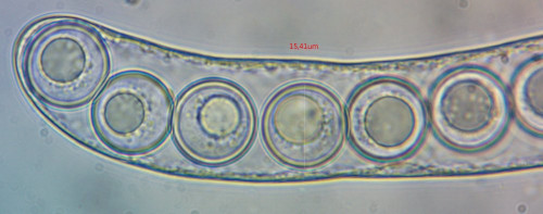 Sphaerosporella brunnea;Spore-Messung;Obj.100xÖl.jpg