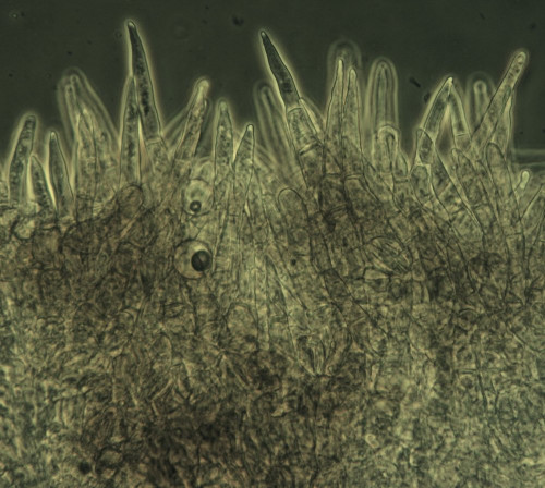 Sphaerosporella brunnea;Randhaare;Obj.40xPhK.jpg