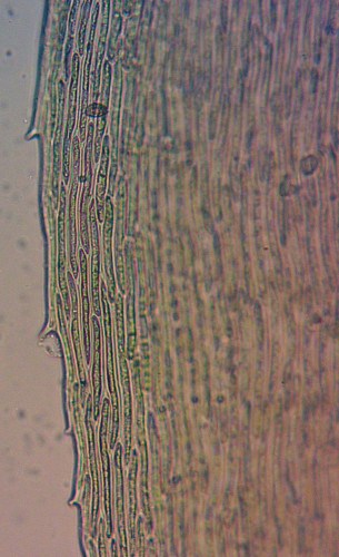 Hylocomium splendens;Blattrand;Obj.40x.jpg