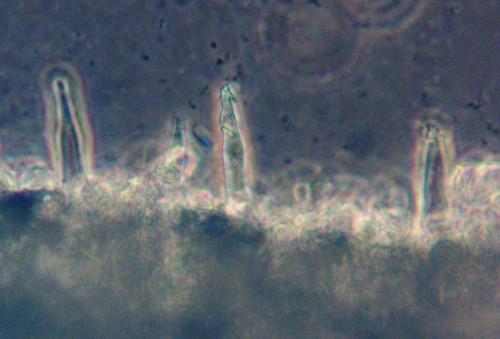 Melanoleuca excissa;Brennhaarzyst.;Obj.40xPhK.jpg