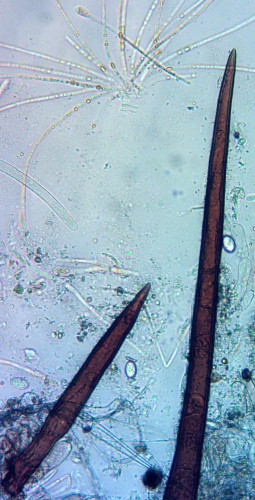 Scutellinia scutellata;Borstenspitze;Obj.20x.jpg