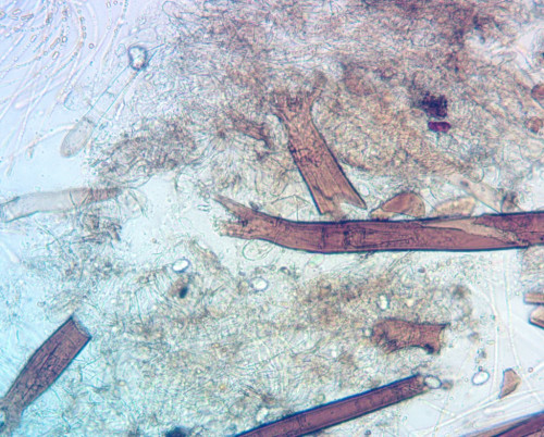 Scutellinia scutellata;Borstenbasis;Obj.20x.jpg
