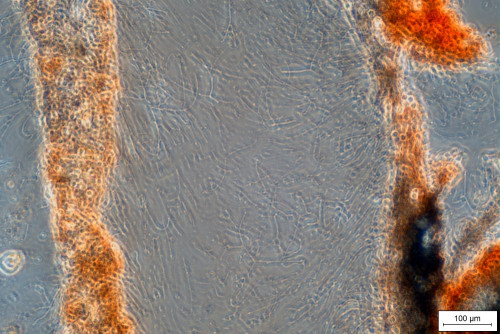 Hohenbuehelia cyphelliformis HDSradial.jpg