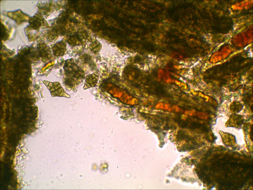 Phragmotrichum chailletii_40-2.jpg