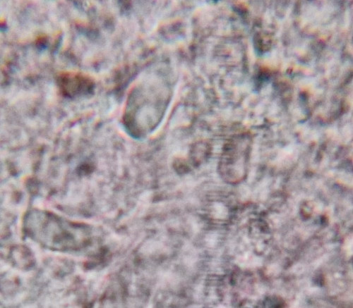Arrehnia griseo M1.jpg