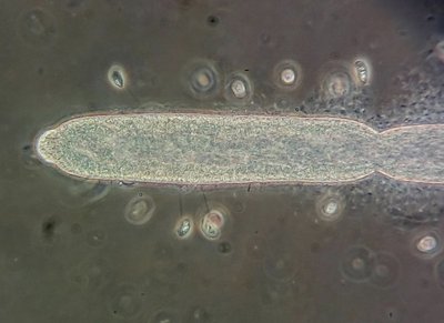 Oomycet,Planosporangium-ESSER- m. Winpertierchen.jpg