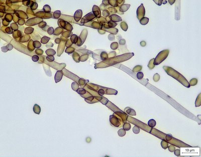 Cladosporium sphaerospermum (1).jpg