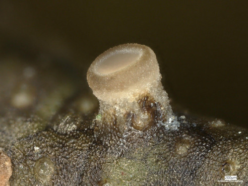 20250530_101724_Bryoscyphus_conocephali.jpg