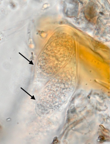 Chaetapiospora_islandica2.jpg