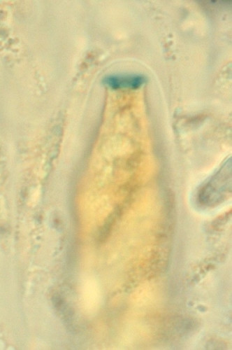 Chaetapiospora_islandica3.jpg
