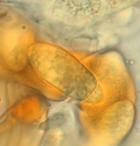 Chaetapiospora_islandica4.jpg