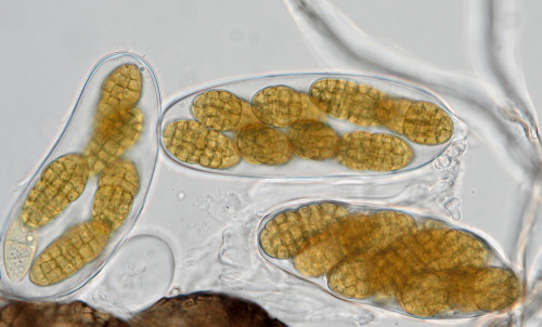 as_Pleospora_aff_leptosphaerulinoides2 .jpg