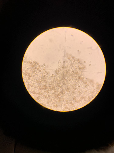 Basidie, 400x