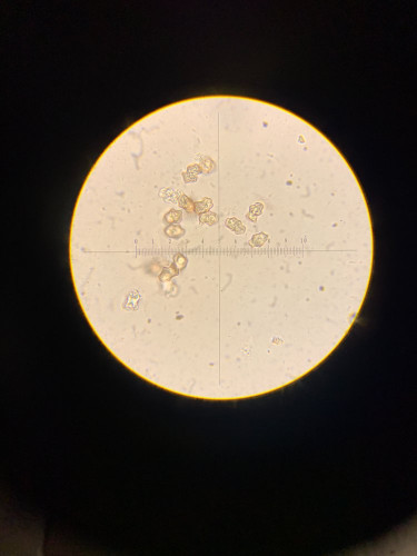 Sporen 1000x