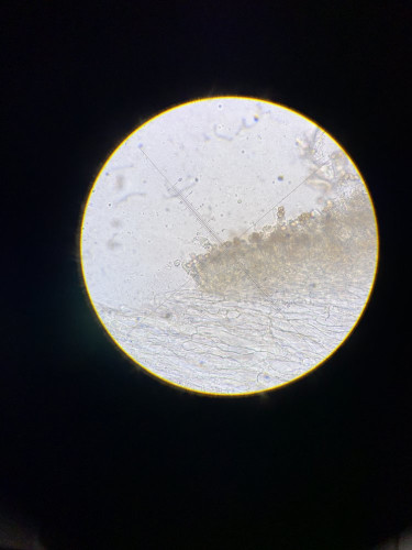 Basidie 400x