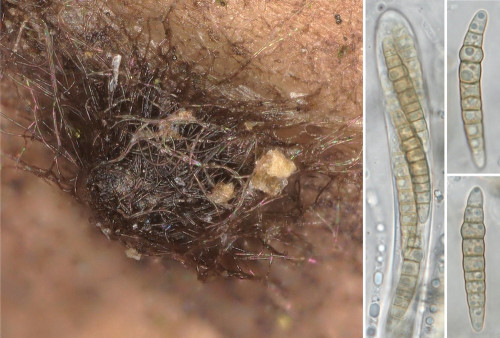 as_Phaeosphaeria herpotrichoides agg..jpg